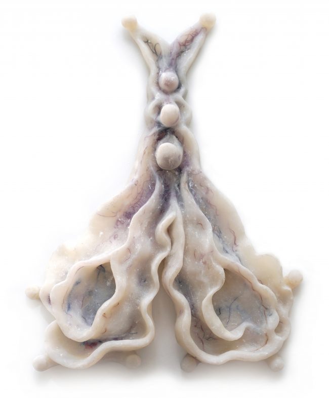 2021 Extension of body